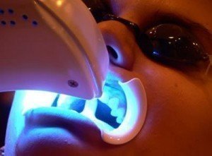 Clarear os dentes
