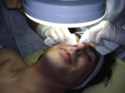Limpeza de pele masculina