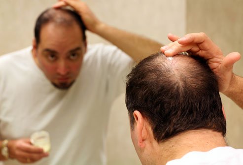 Resultado de imagem para Perda De Cabelo
