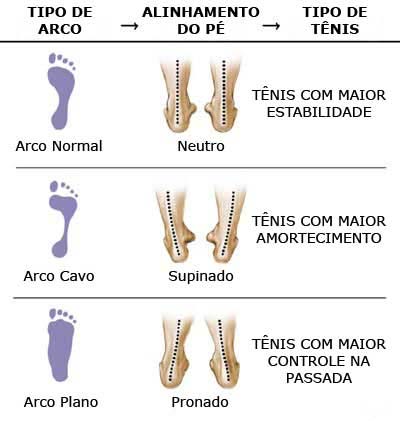 Tipos diferentes de pisada
