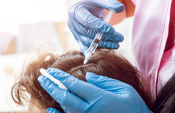 Tratamento de intradermoterapia capilar