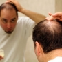 Como evitar a queda de cabelo?