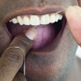 Como deixar os dentes brancos? Receita caseira de como fazer!